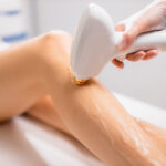 Close Up Woman's Legs While Getting Hair Removal Procedure In Salon