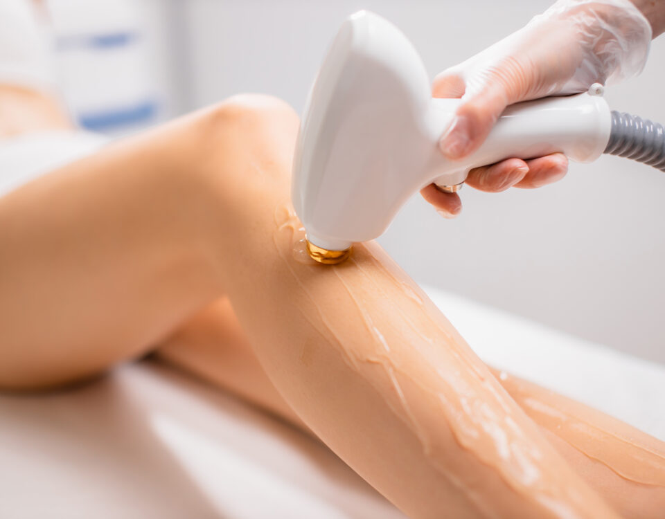 Close Up Woman's Legs While Getting Hair Removal Procedure In Salon