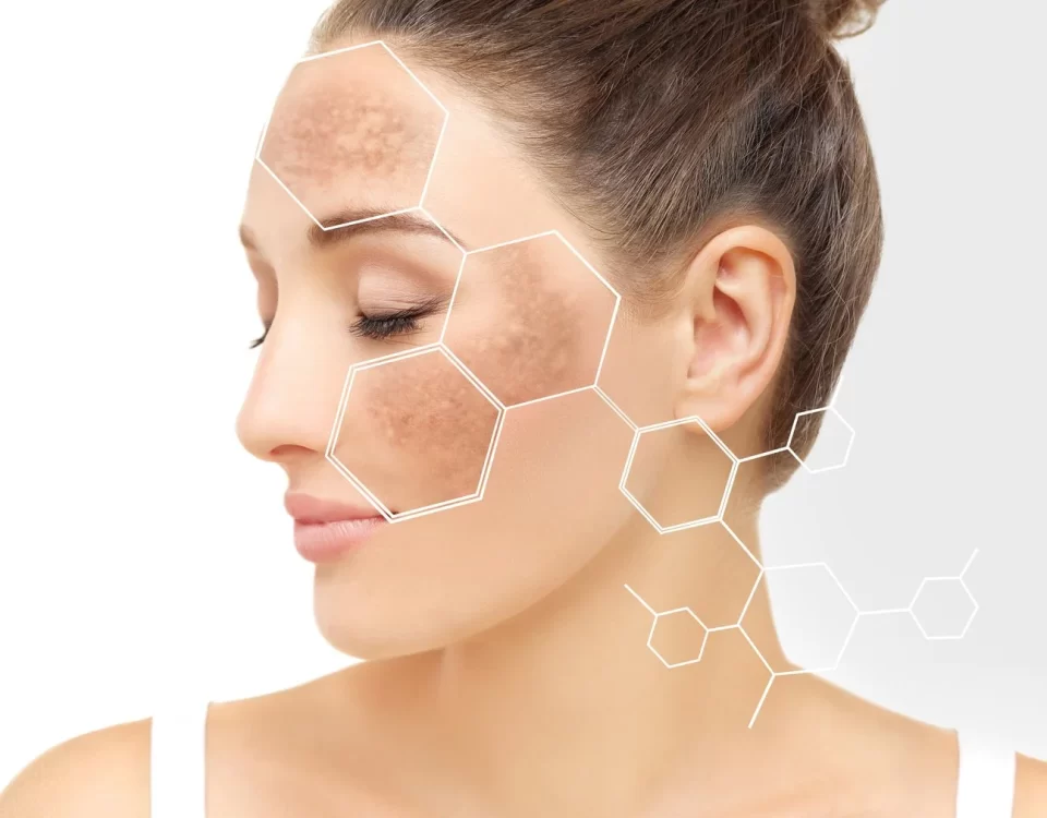 Manchas en la piel 3